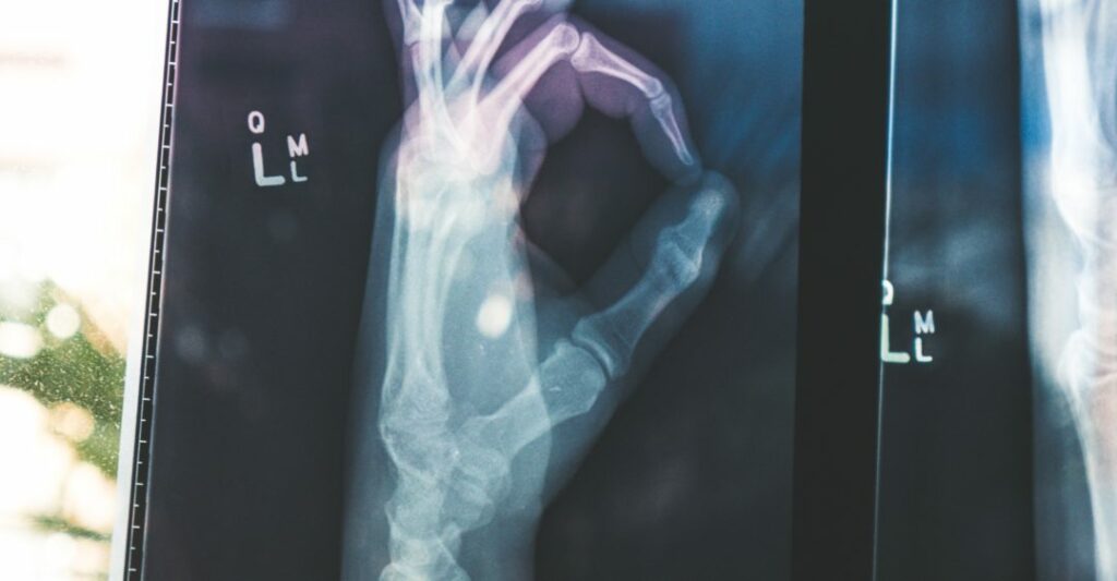 Comprehensive health insurance